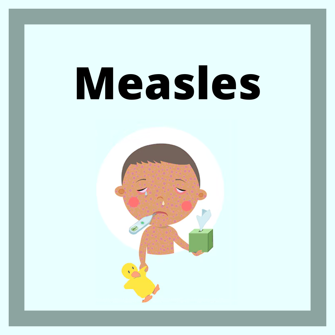 Measles